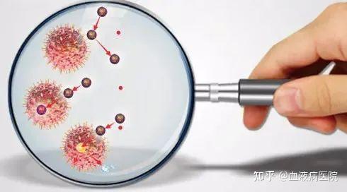 “隐秘”的“血液杀手”！多发性骨髓瘤易被误诊 体检有这个异常需注意
