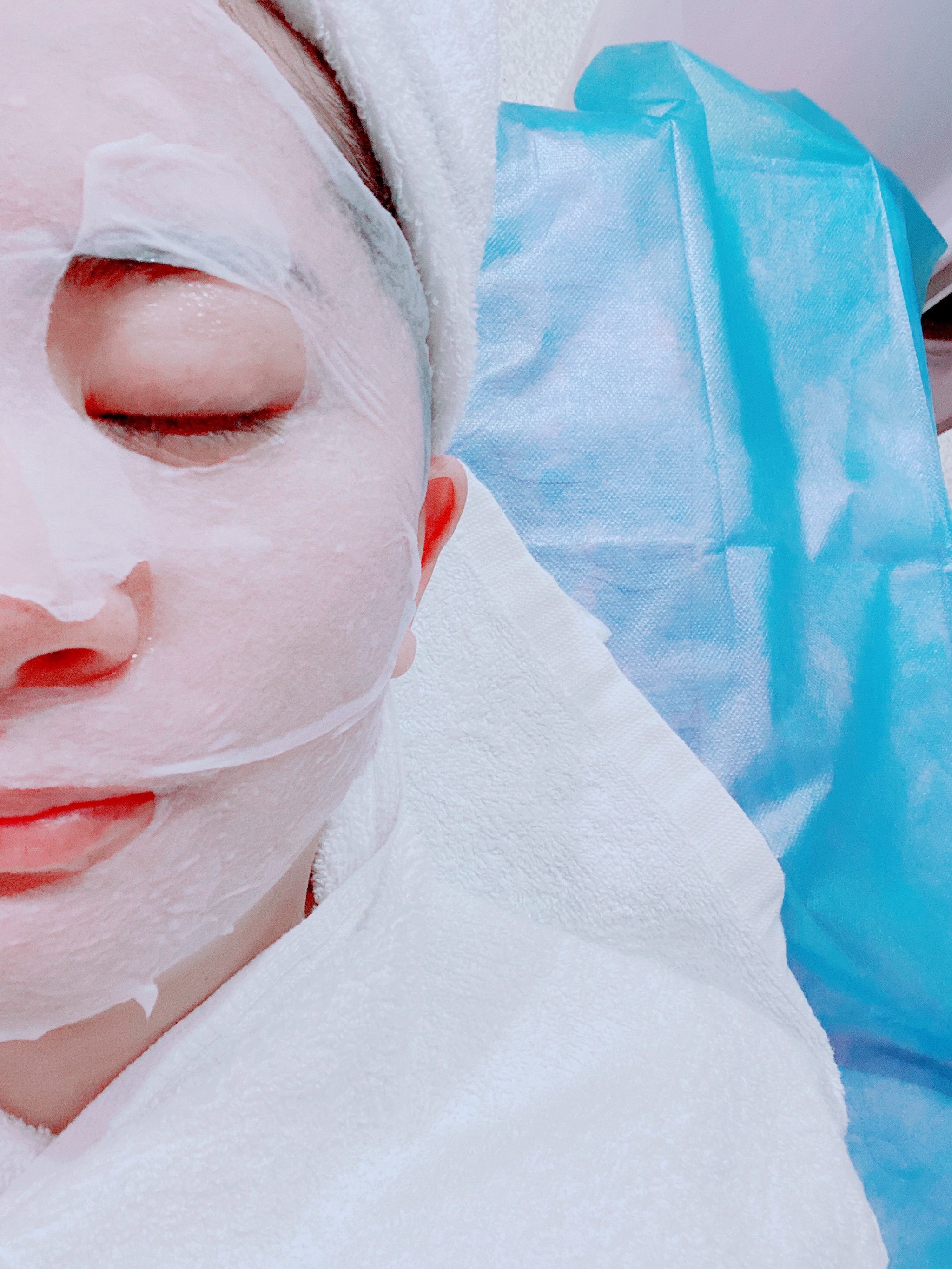 键凯科技：凝胶项目仍在审评中，水光针项目正进行申报前准备