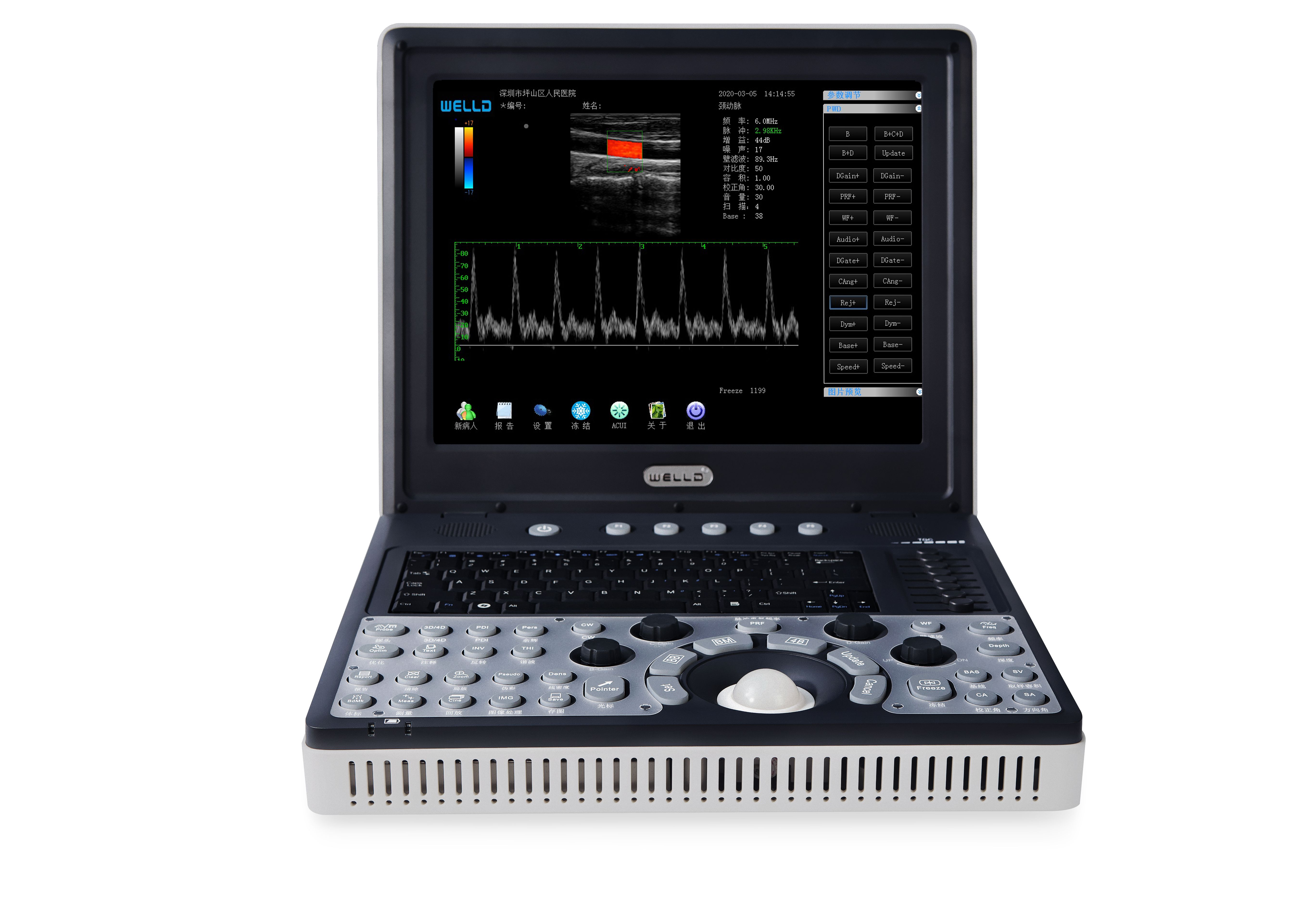 宏达高科:公司会继续加强在医疗器械产业的投入,增强威尔德的产品竞争力